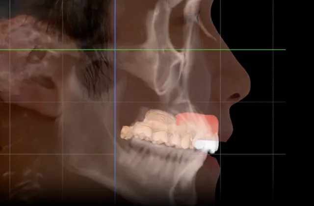 designing step of digital surgery using R2Studio Q