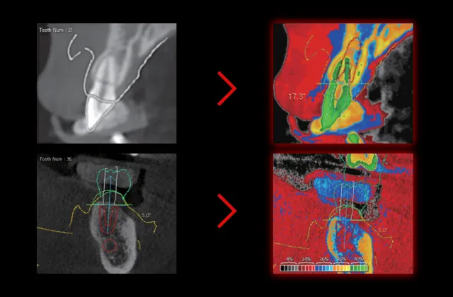 Color coded data to see bone condition