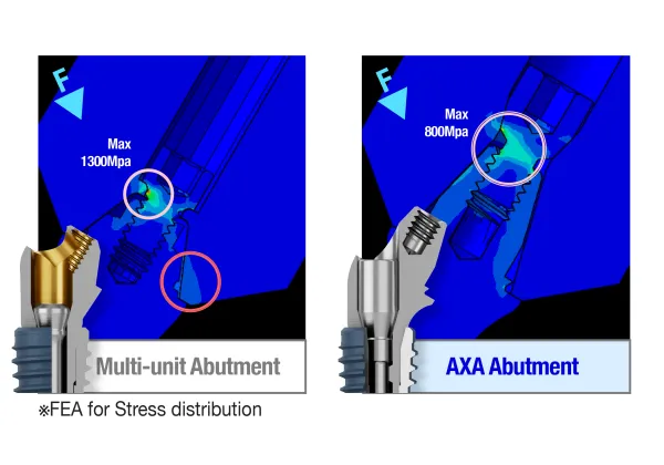 Reinforced design overcomes weaknesses of conventional abutments.