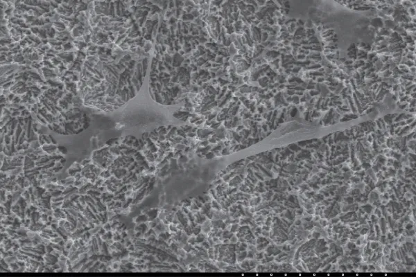 Magnified illustration of bone structure